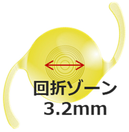 回折ゾーン3.2mm