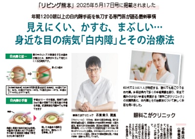 リビング熊本 2025年5月17日号 白内障手術